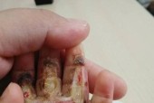 跑步机带子断了怎么办？如何快速更换？