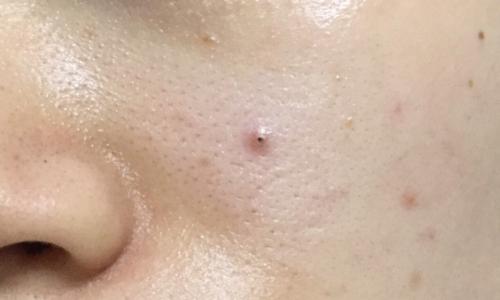 如何解决热水器水管里的气泡问题（简单有效的去除气泡方法）  第3张